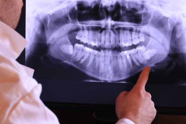 Best Urgent Tooth Repair  in Timberlake, VA