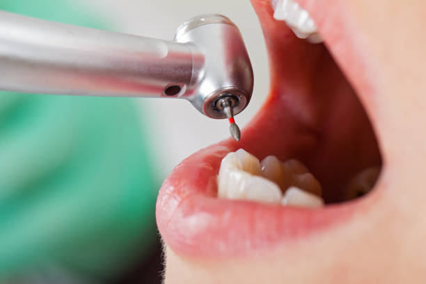 Best Urgent Tooth Repair  in Timberlake, VA